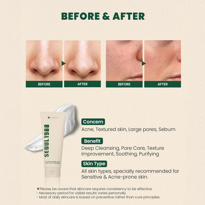 SEOUL 1988 Cleansing Foam : Pine Cica 1% + Probiotics